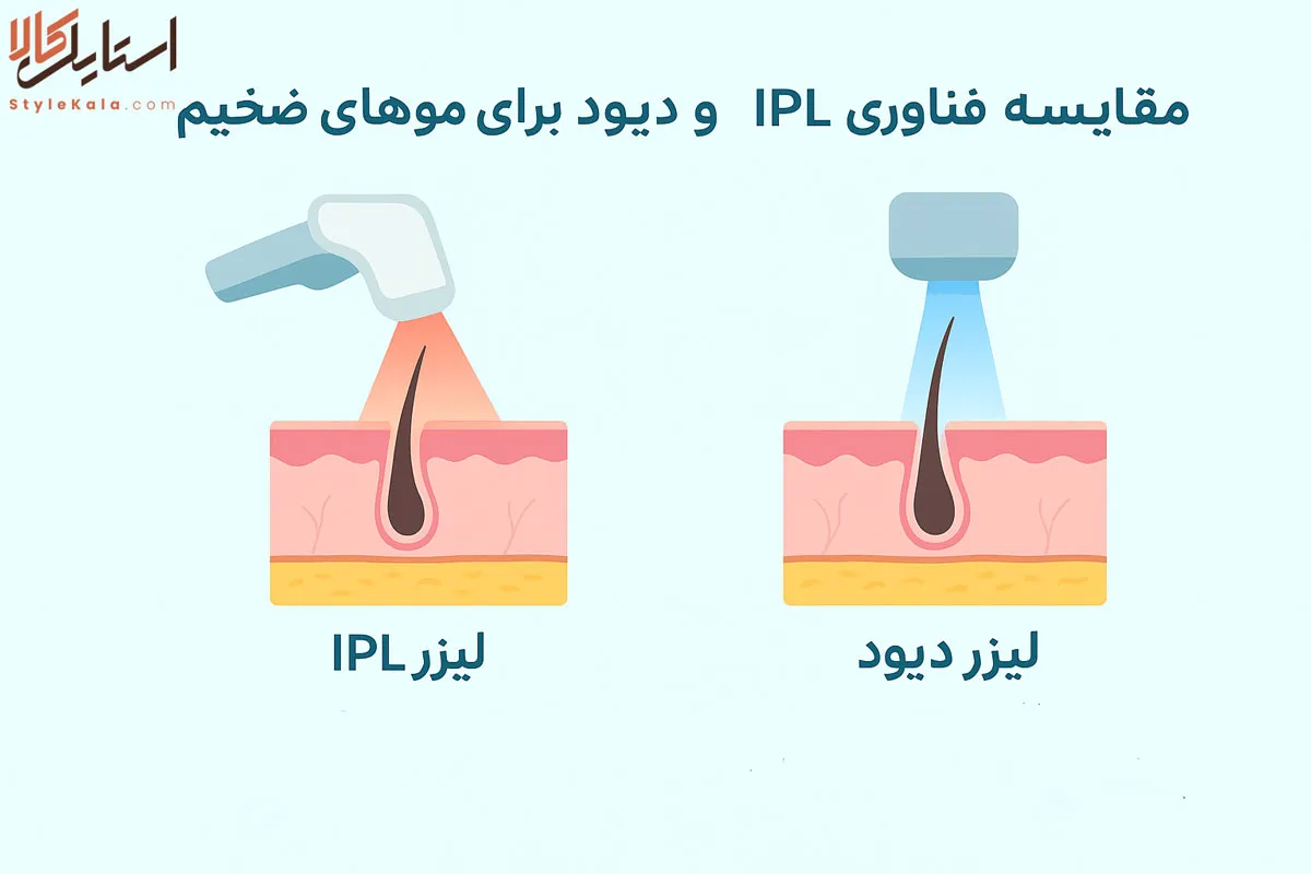 کدام فناوری بهتر است؟ IPL یا دیود برای موهای ضخیم